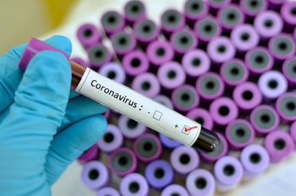 texas cases of coronavirus, quiz on coronavirus, coronavirus who